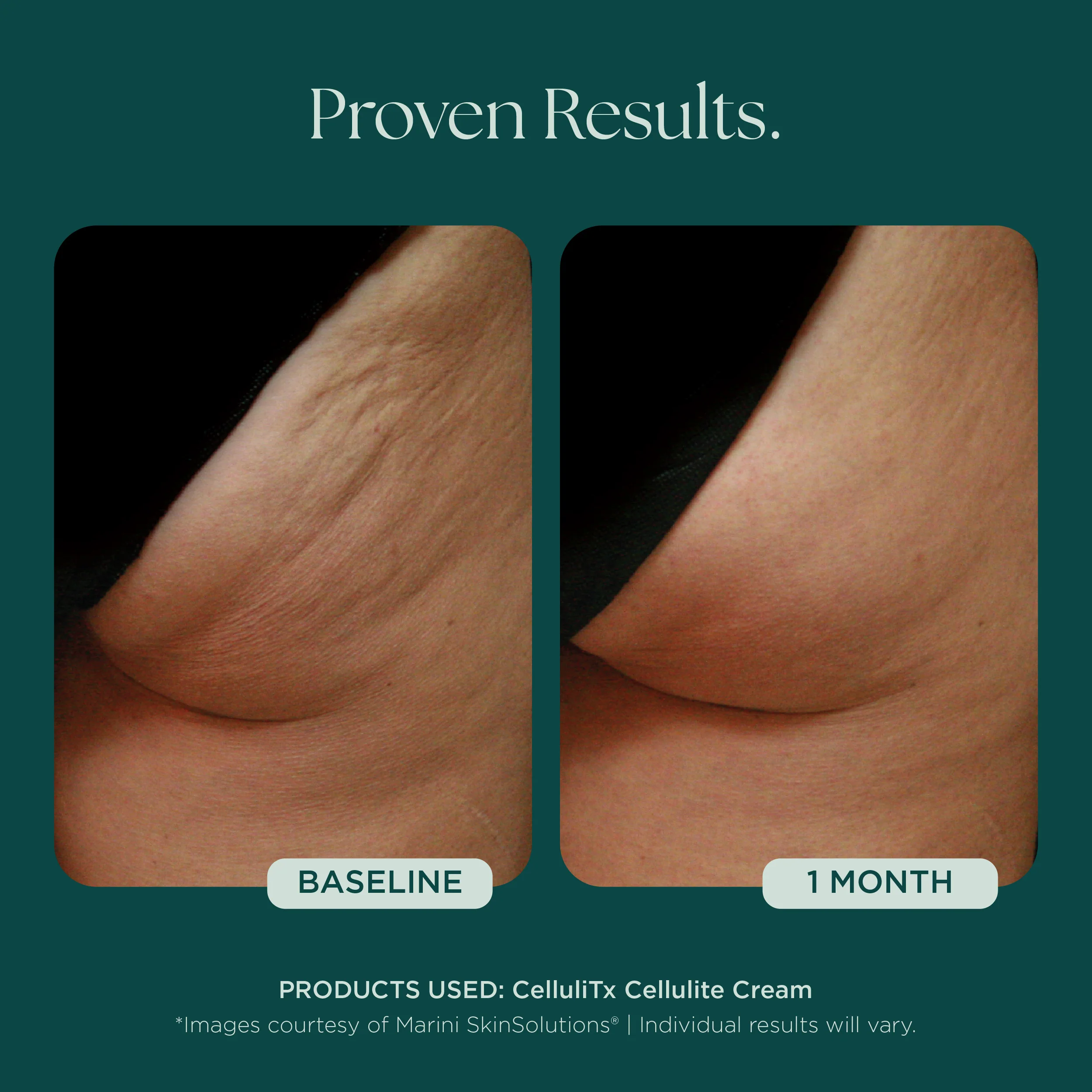 CelluliTX Cellulite Cream - Image 6