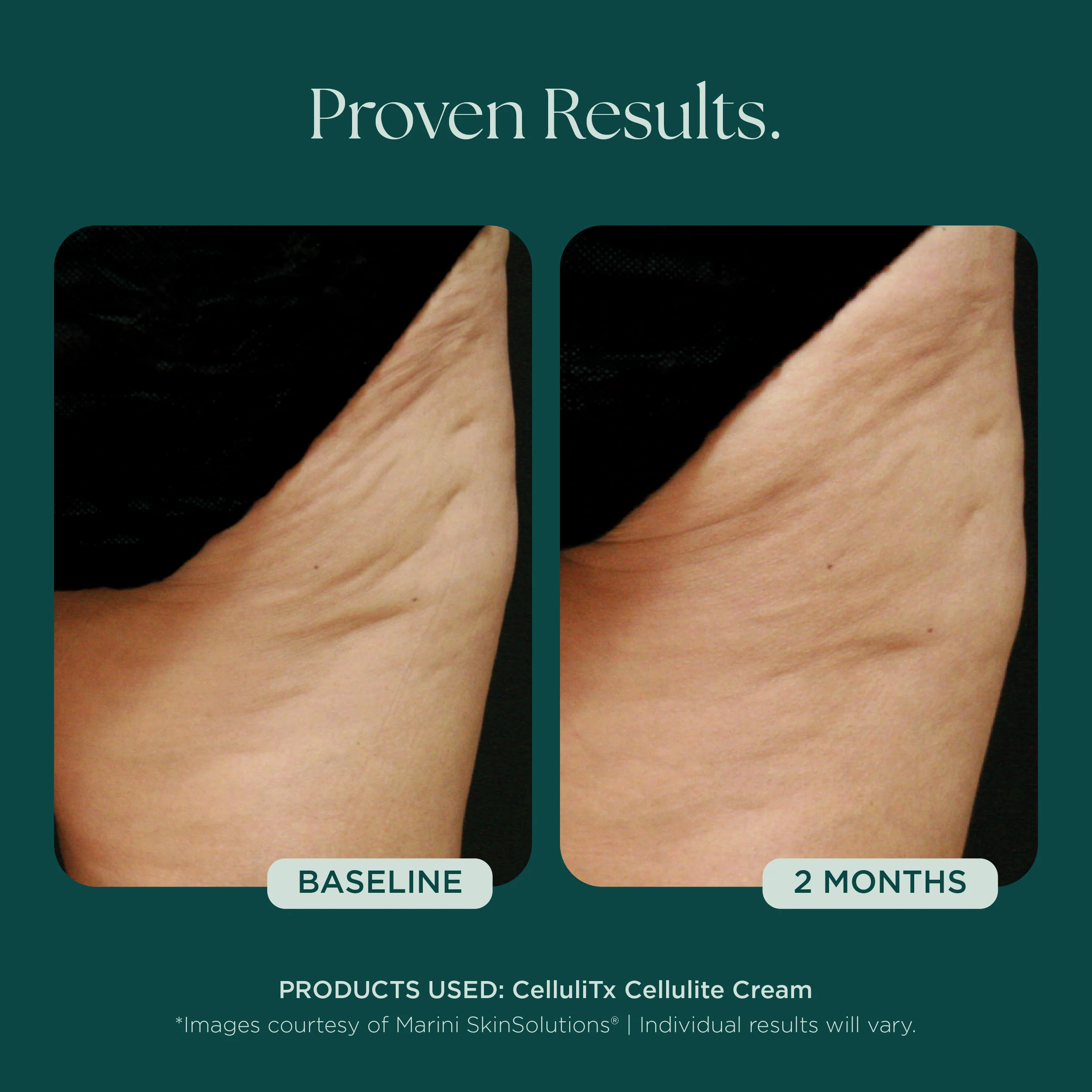 CelluliTX Cellulite Cream - Image 7