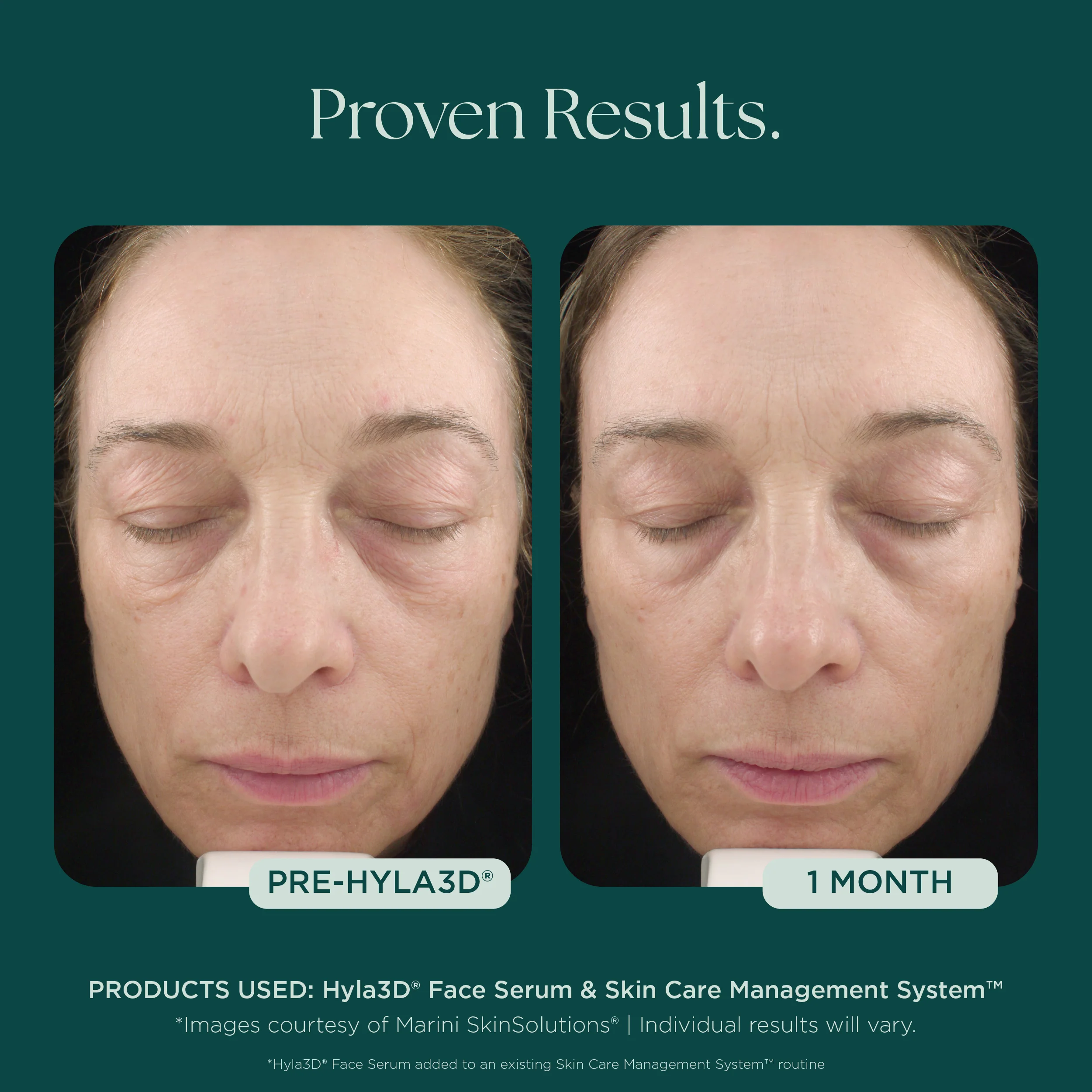 Hyla3D® Face Serum Hyaluronic Acid Complex - Image 6