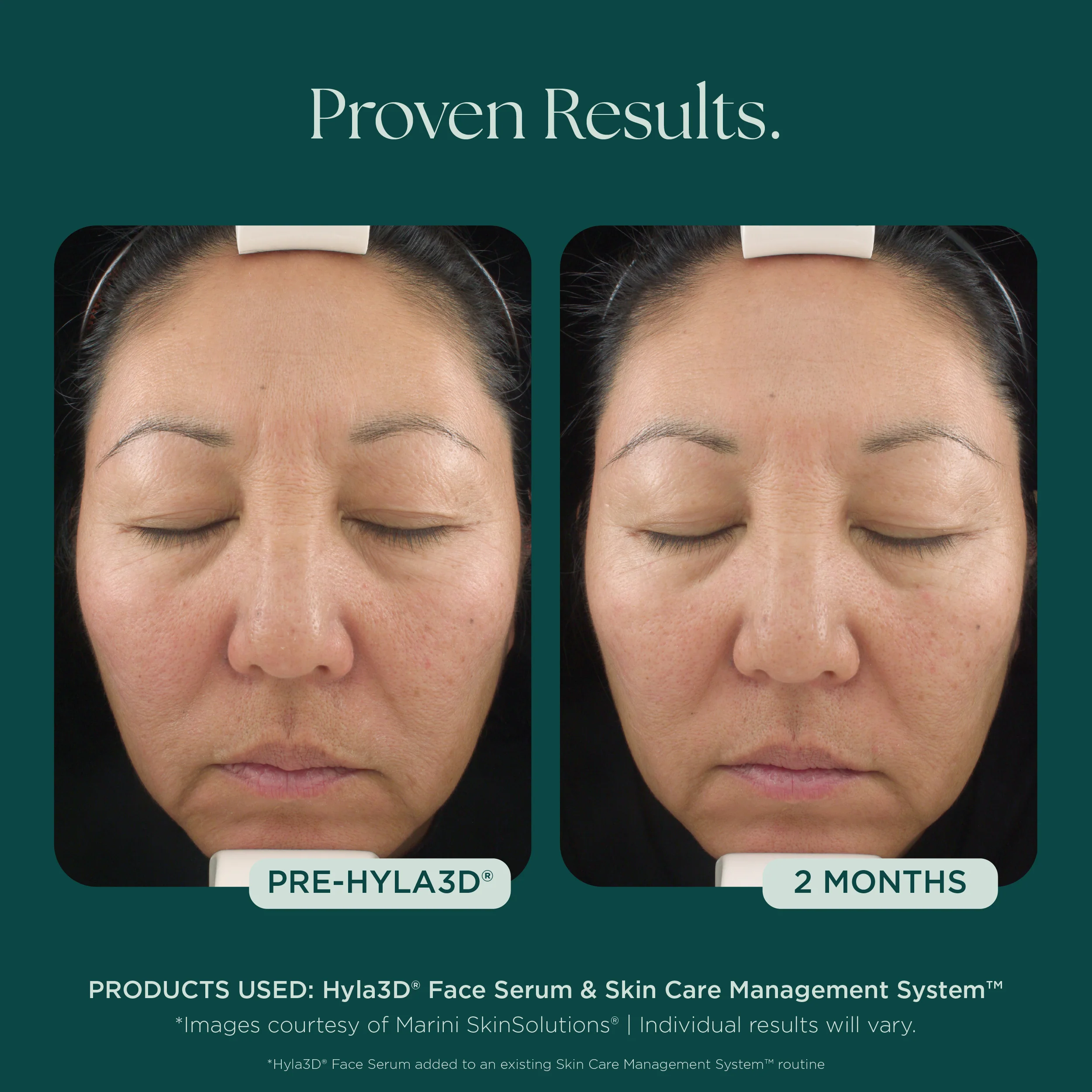 Hyla3D® Face Serum Hyaluronic Acid Complex - Image 7