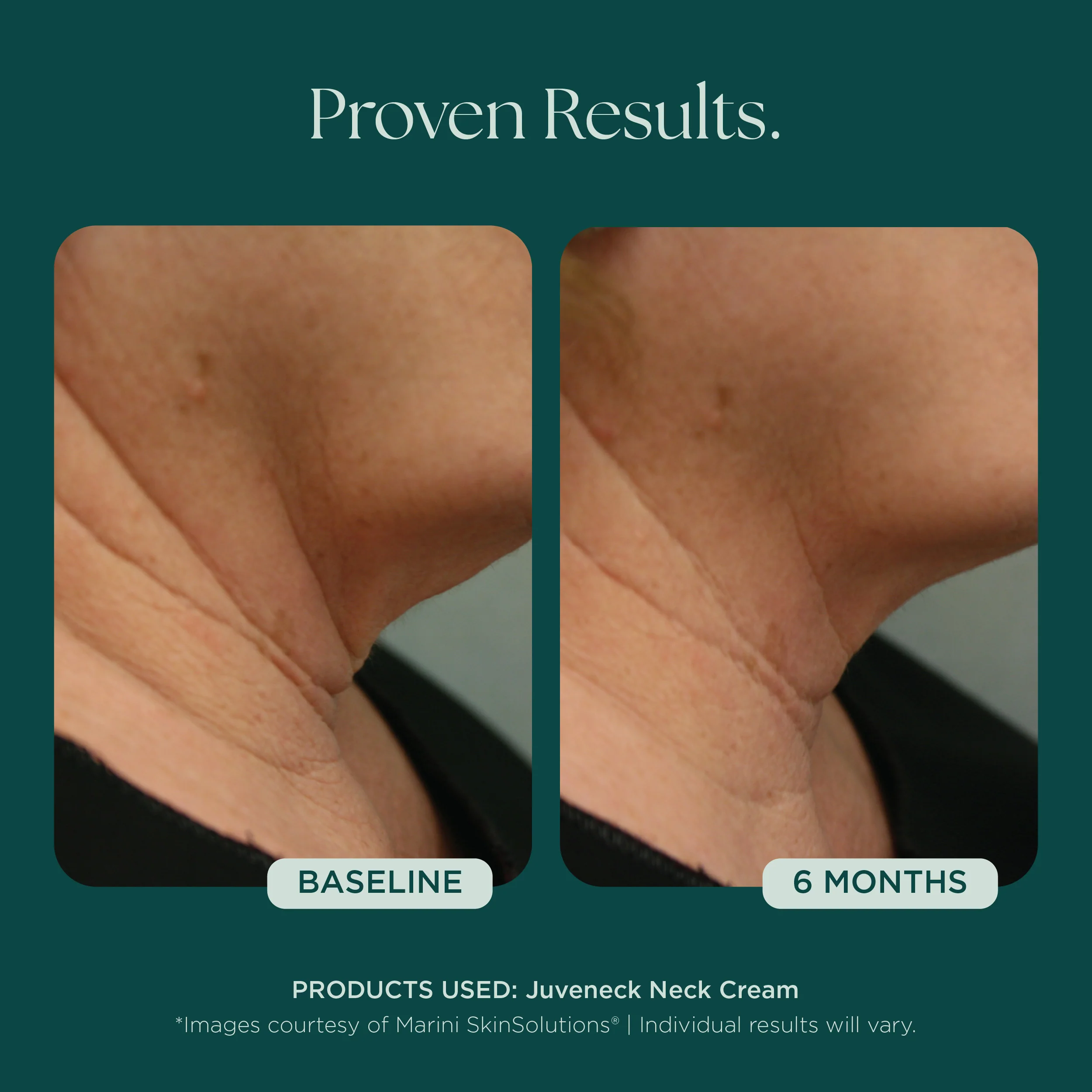 Juveneck Neck Cream - Image 5