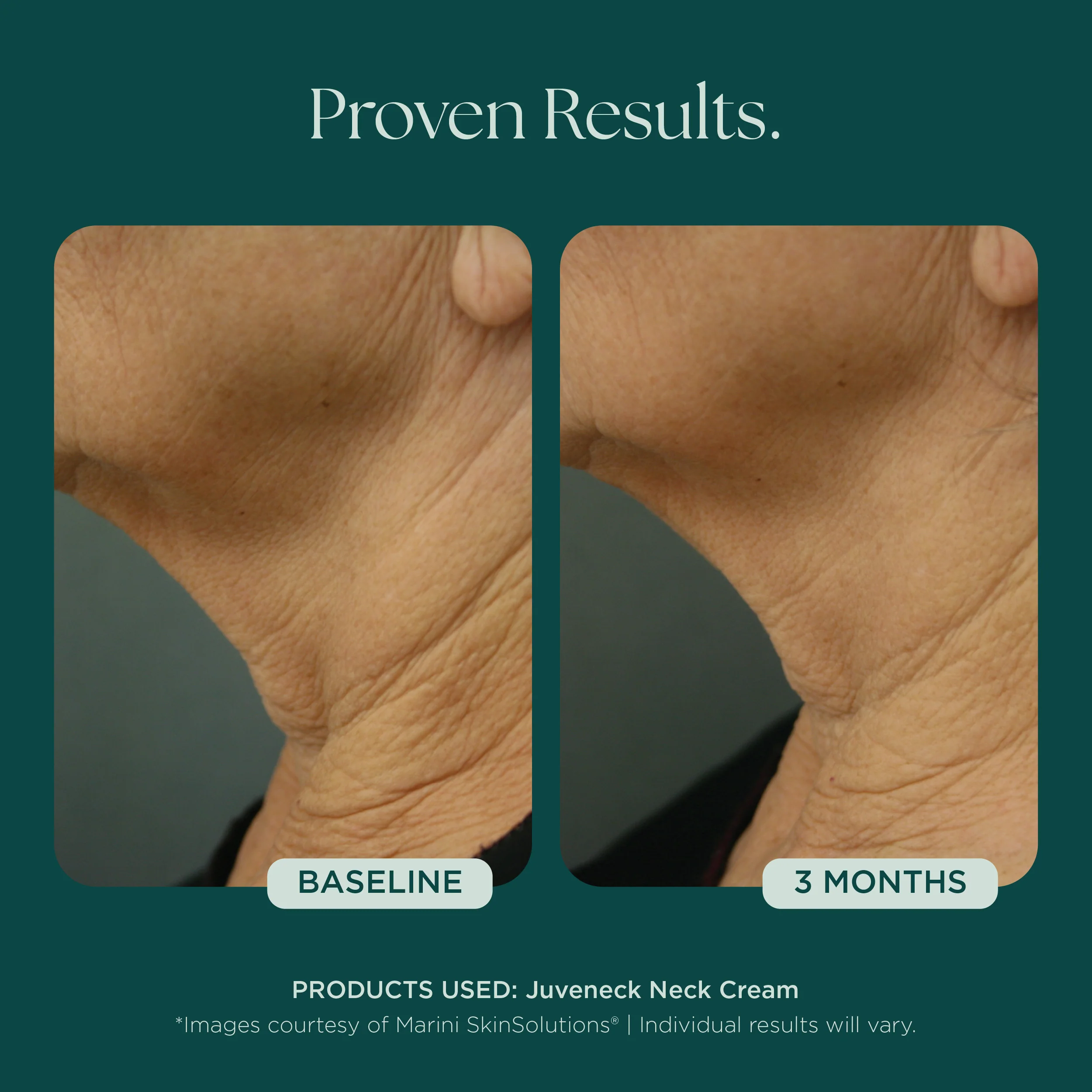 Juveneck Neck Cream - Image 6