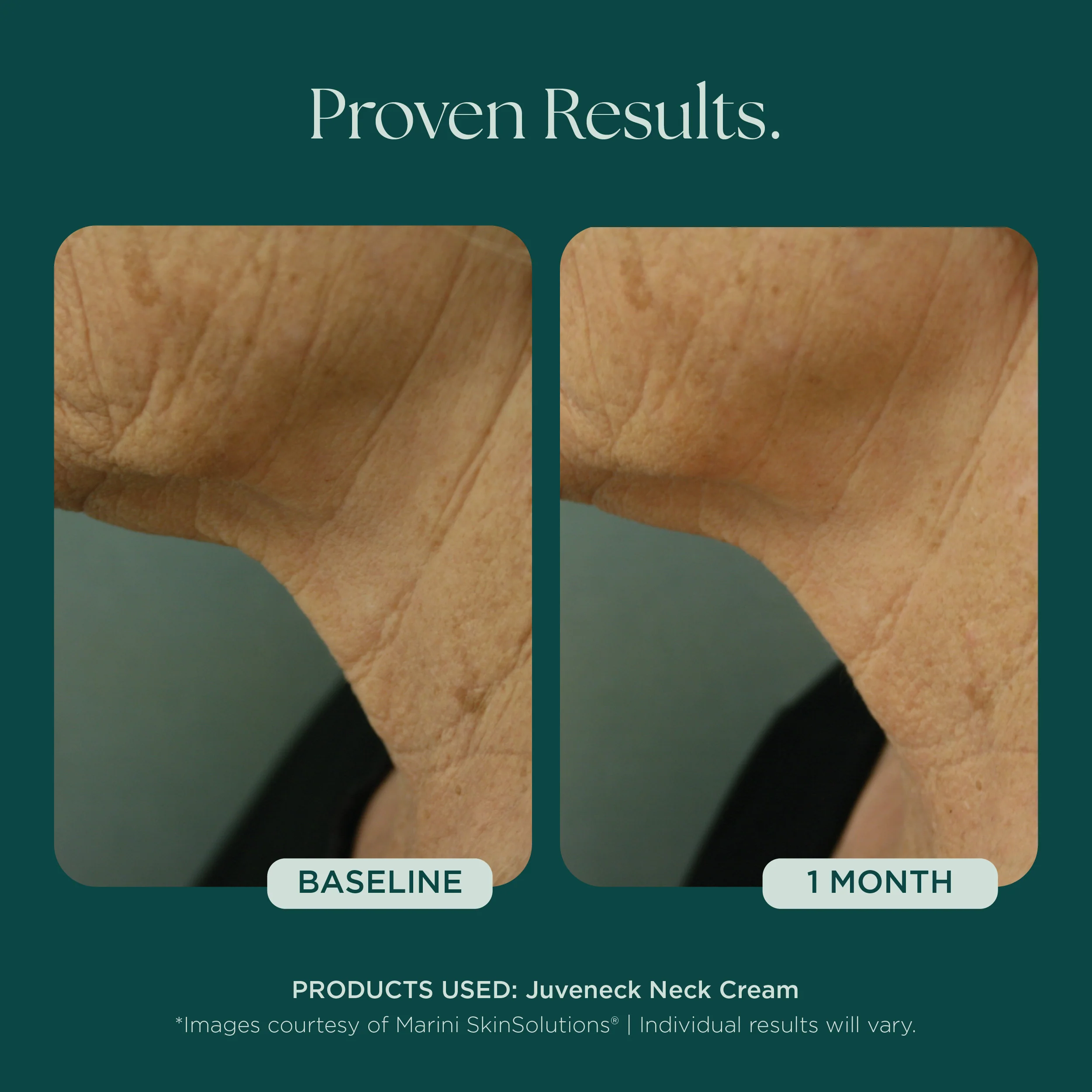Juveneck Neck Cream - Image 7