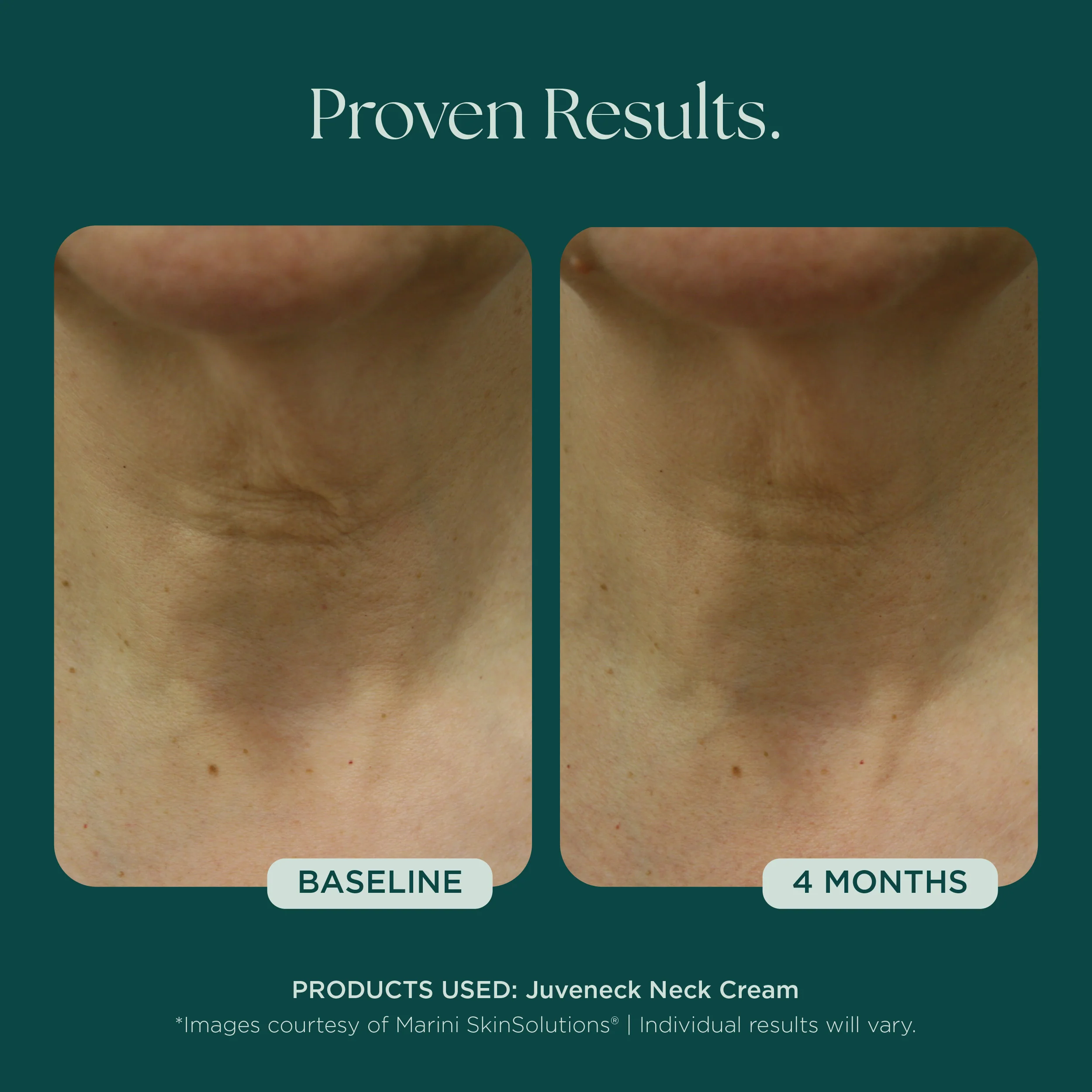 Juveneck Neck Cream - Image 8