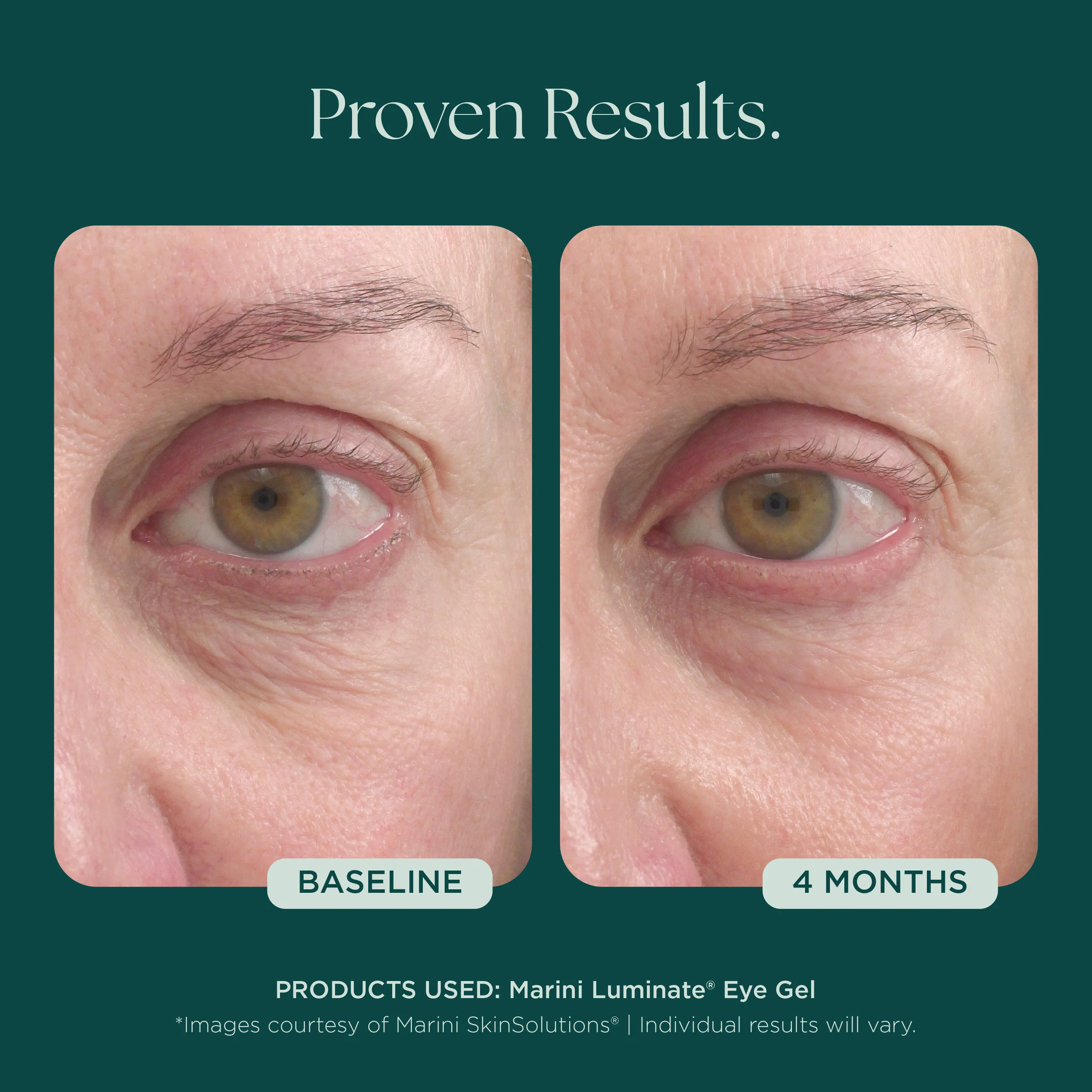 Marini Luminate® Eye Gel - Image 5