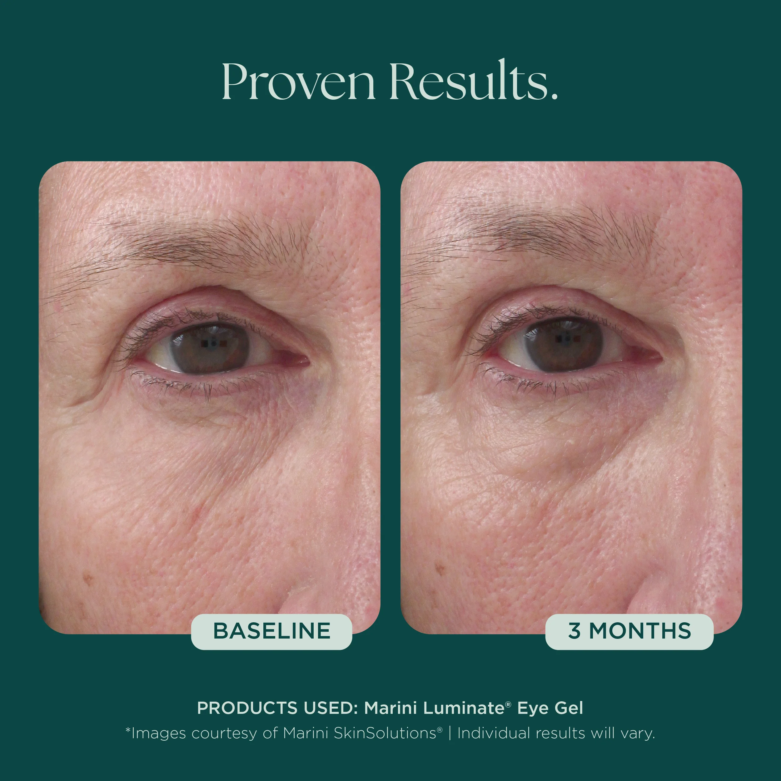 Marini Luminate® Eye Gel - Image 6