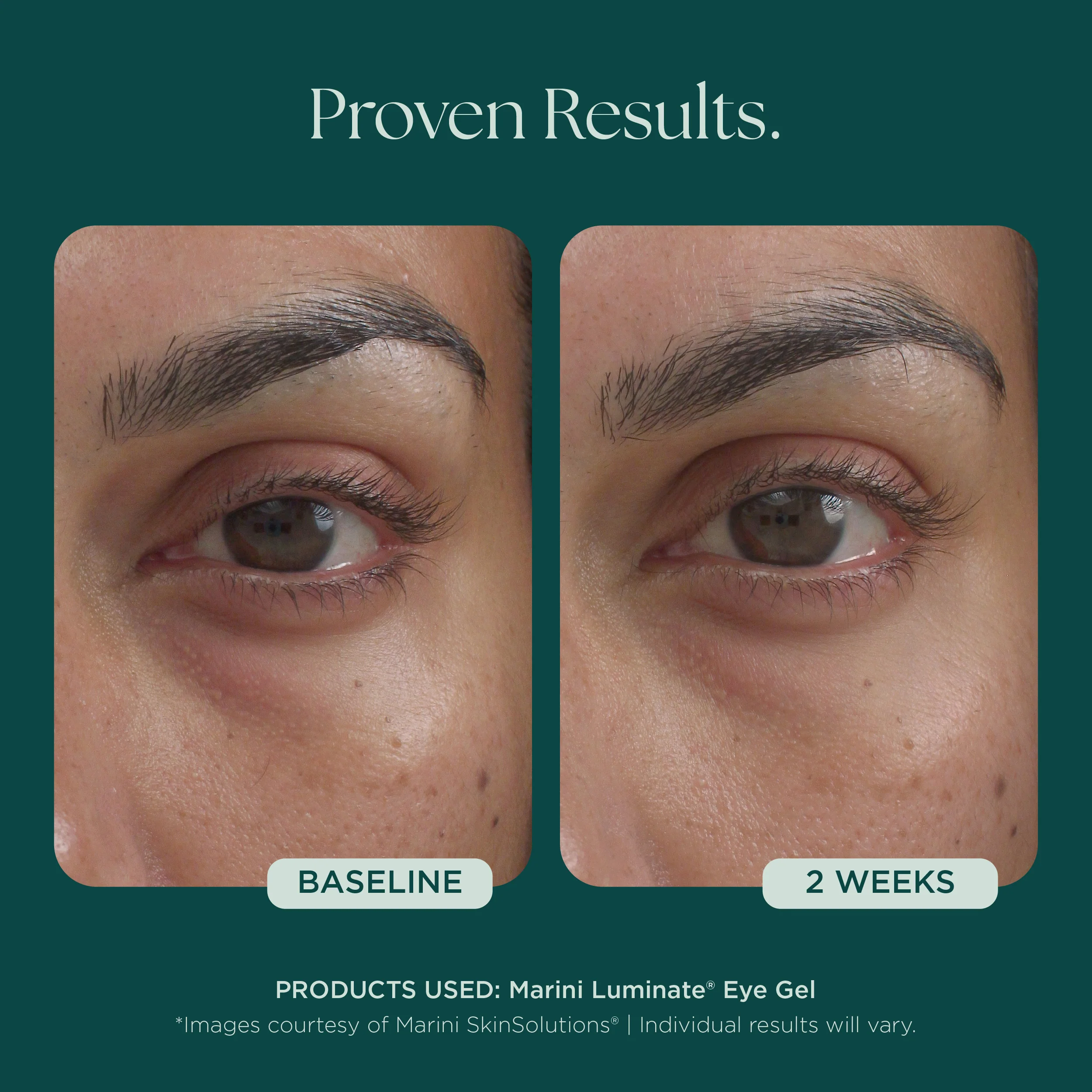 Marini Luminate® Eye Gel - Image 7