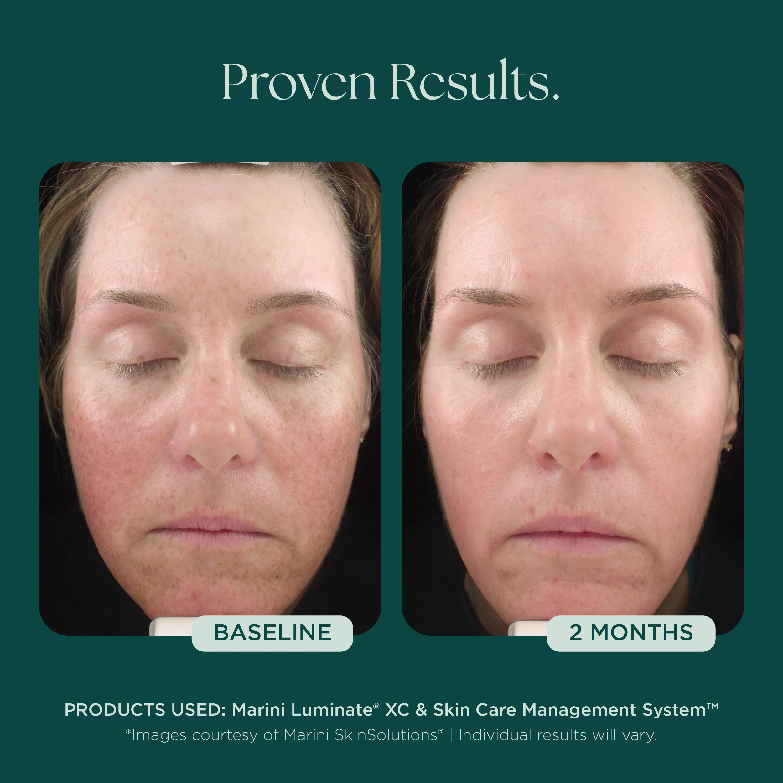Marini Luminate® - Image 6