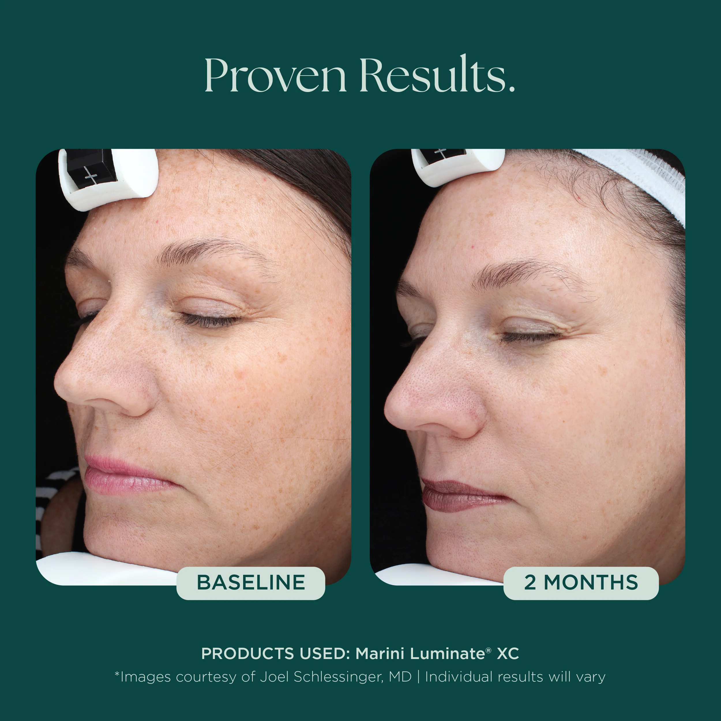 Marini Luminate® - Image 7