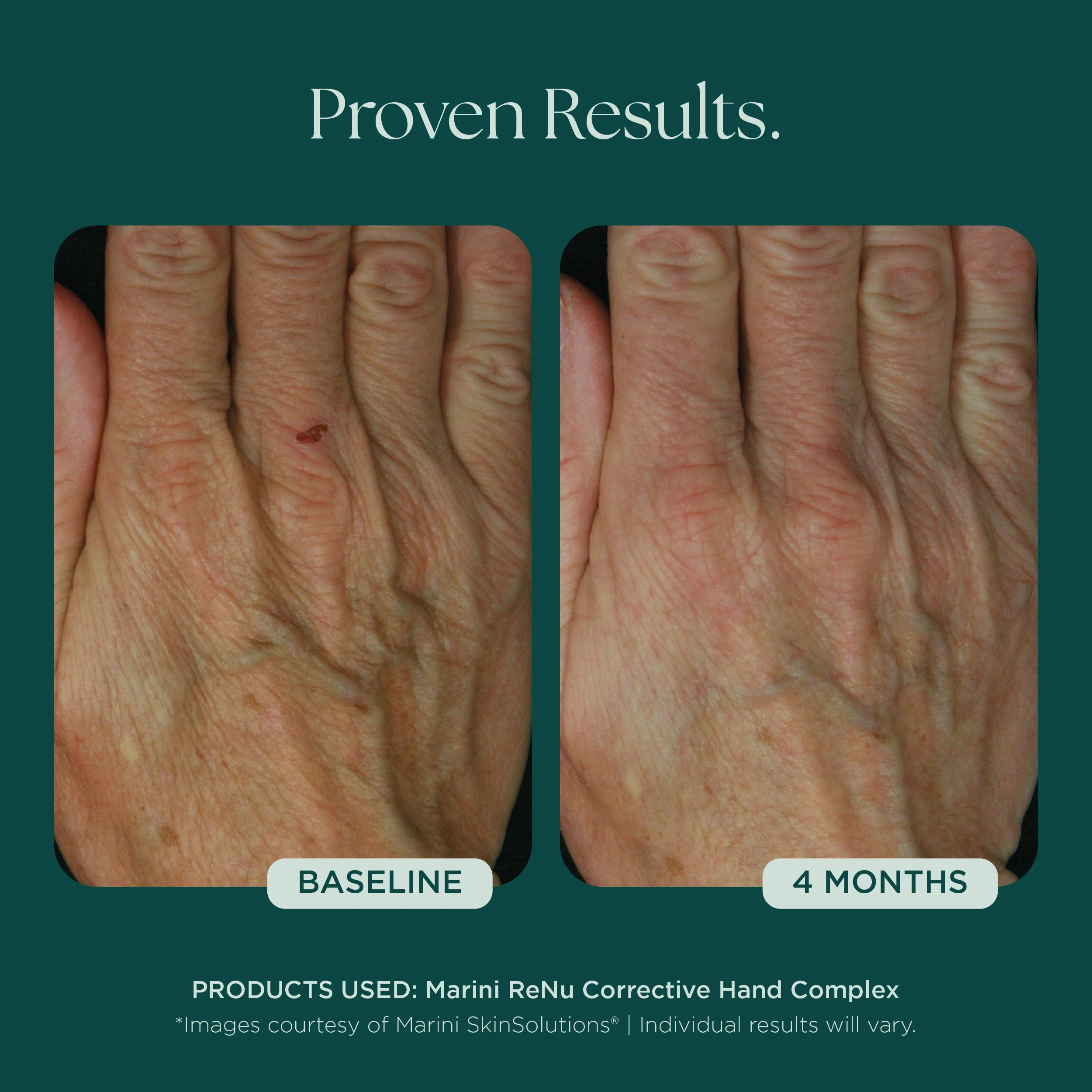 Marini ReNu Corrective Hand Complex - Image 5