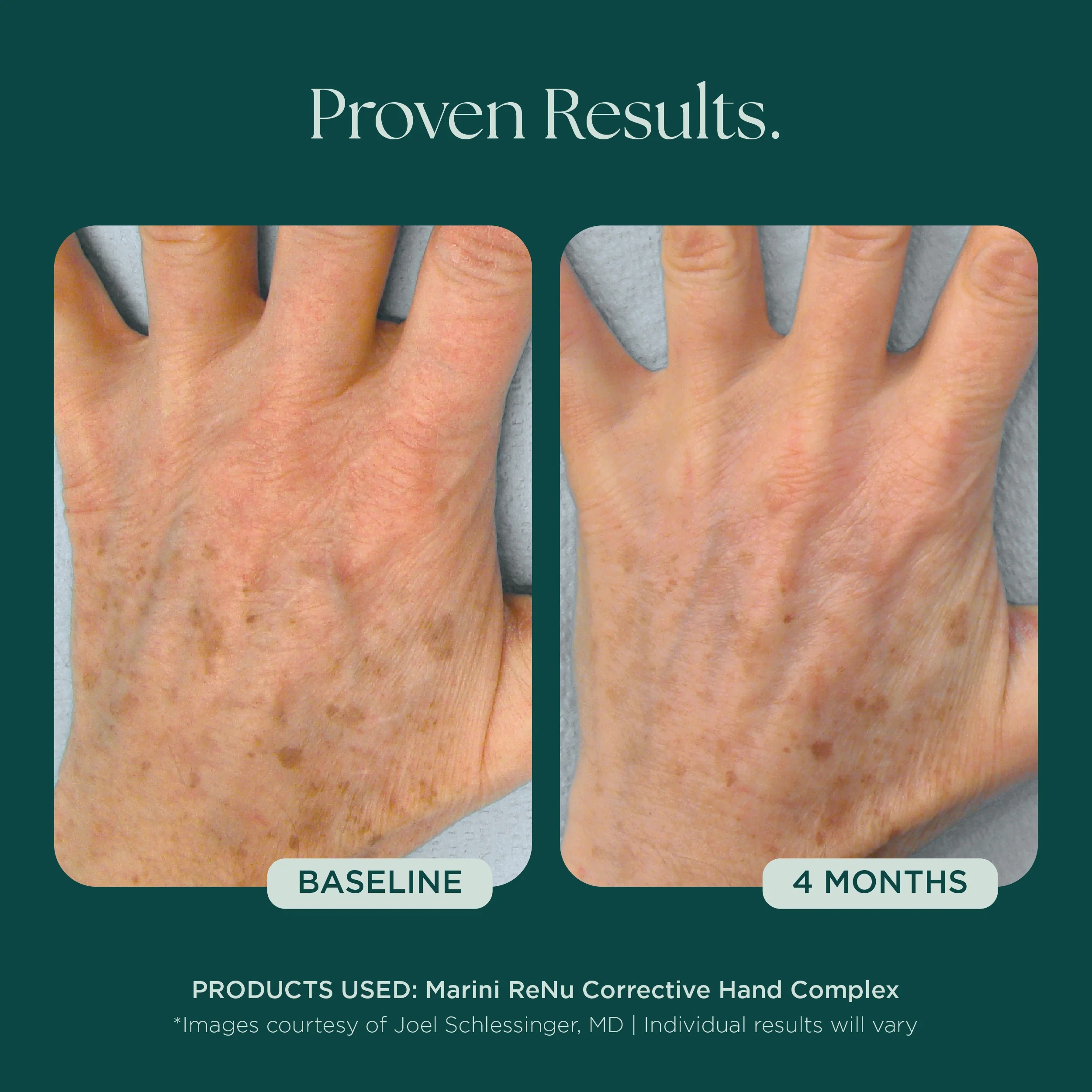 Marini ReNu Corrective Hand Complex - Image 6