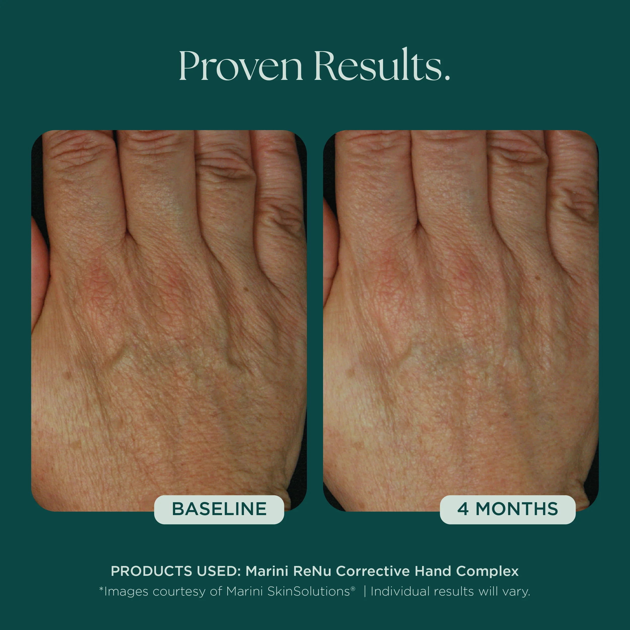 Marini ReNu Corrective Hand Complex - Image 7