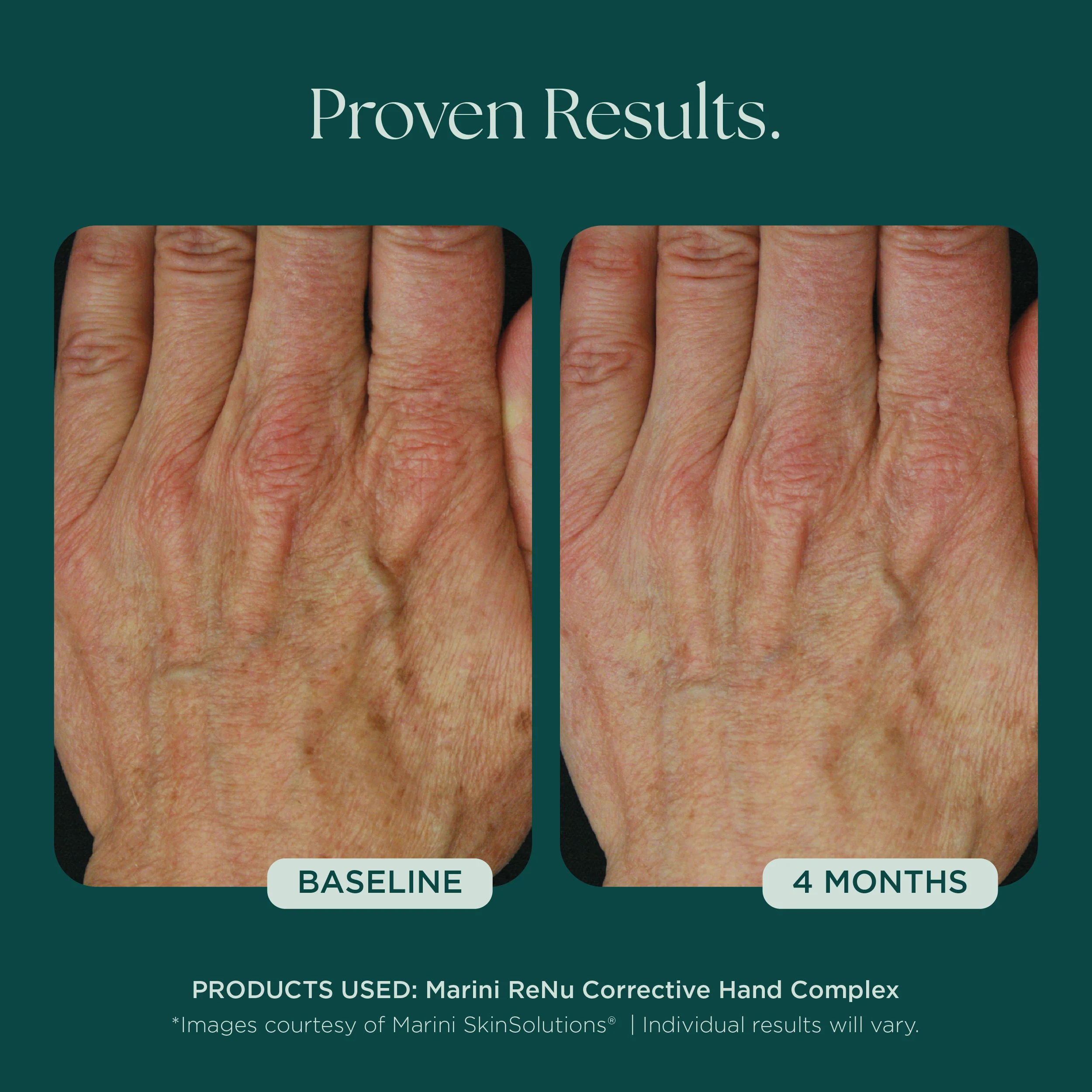 Marini ReNu Corrective Hand Complex - Image 8