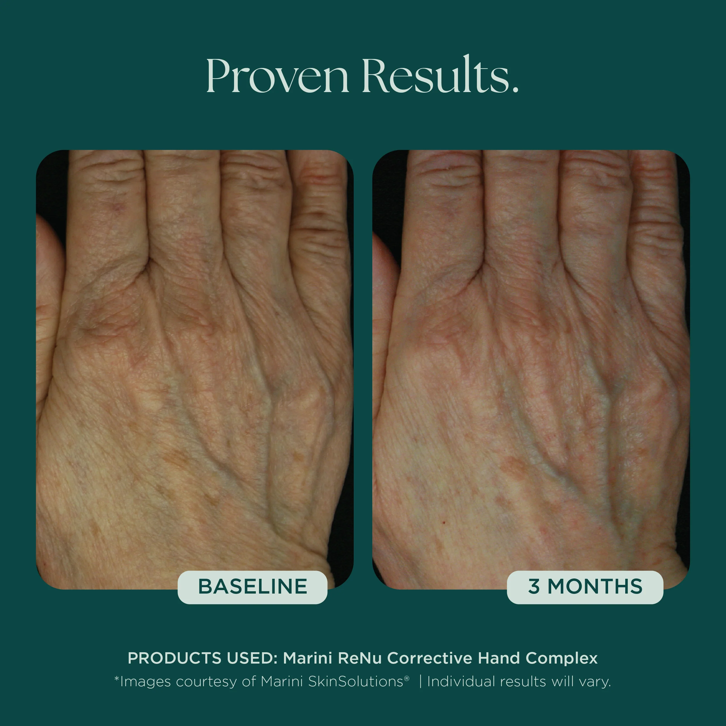 Marini ReNu Corrective Hand Complex - Image 9