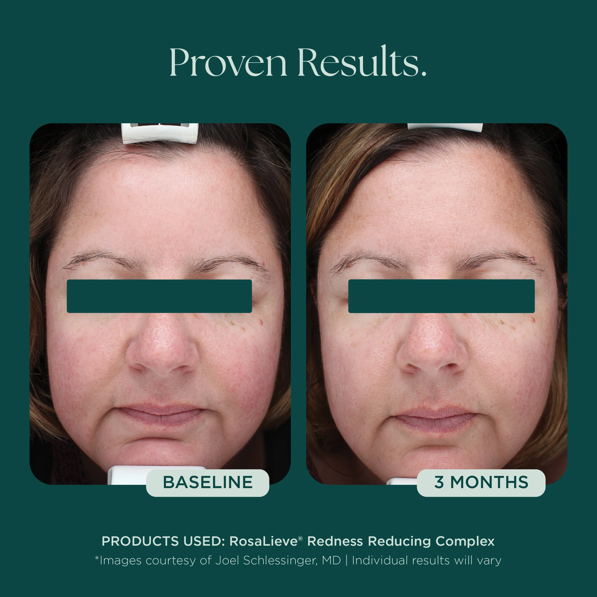 RosaLieve® Redness Reducing Complex - Image 10