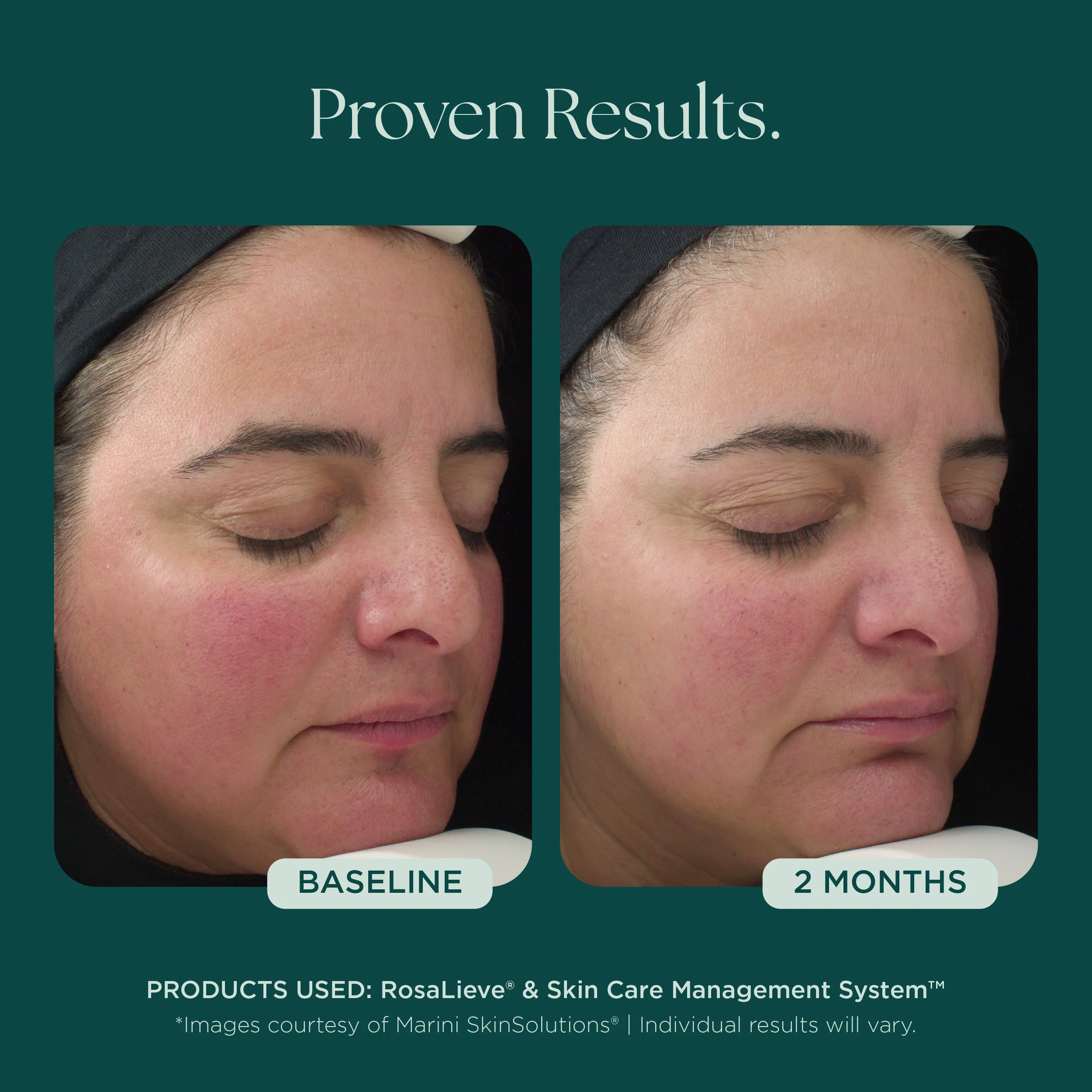RosaLieve® Redness Reducing Complex - Image 5