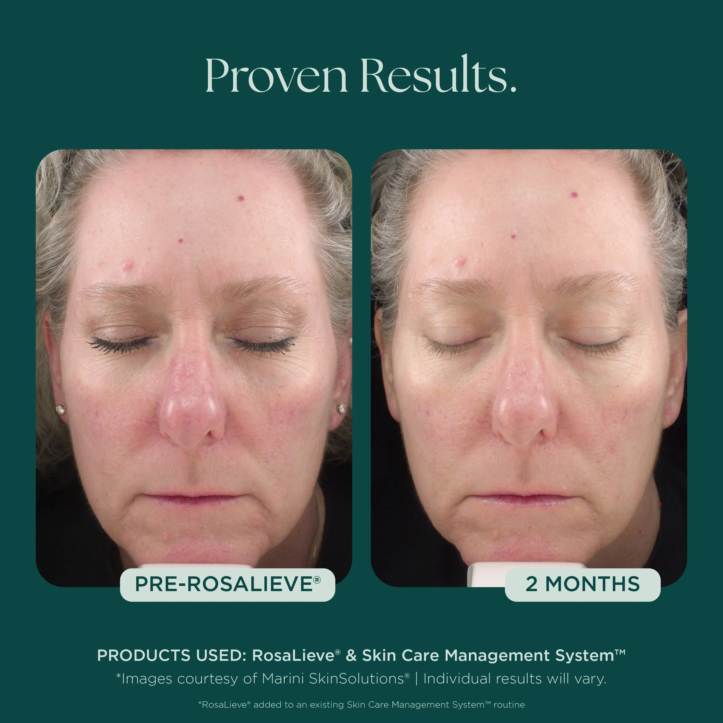 RosaLieve® Redness Reducing Complex - Image 6