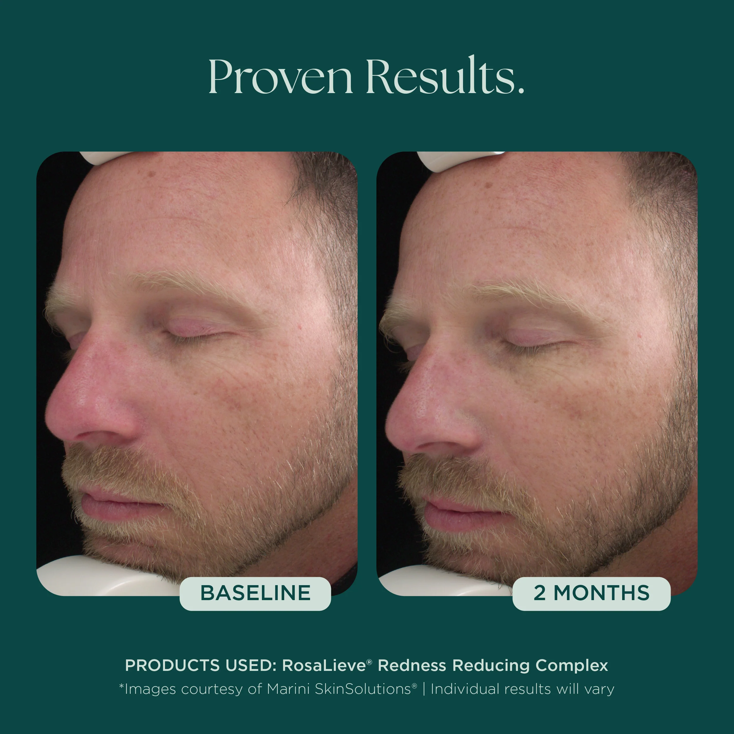 RosaLieve® Redness Reducing Complex - Image 7