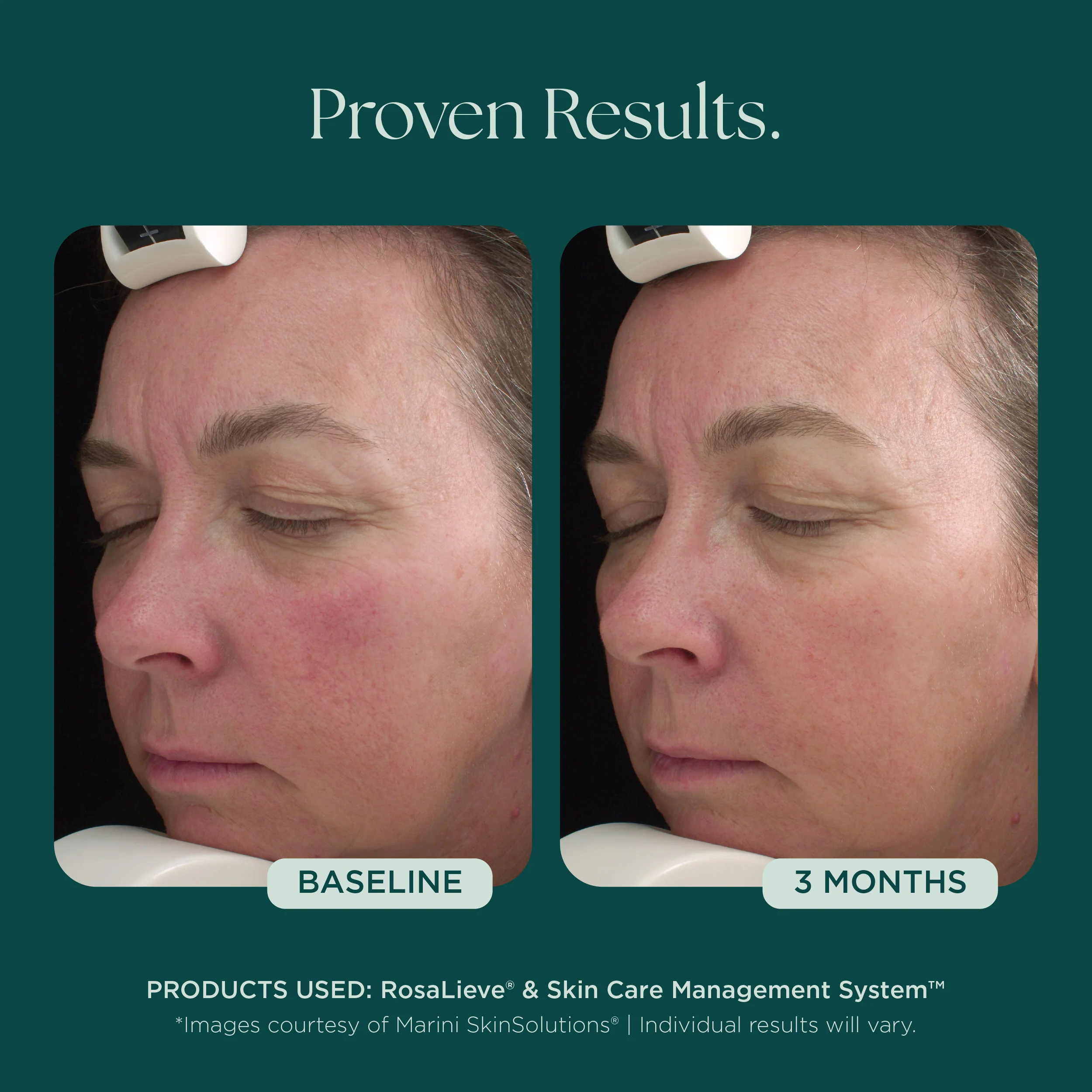 RosaLieve® Redness Reducing Complex - Image 8